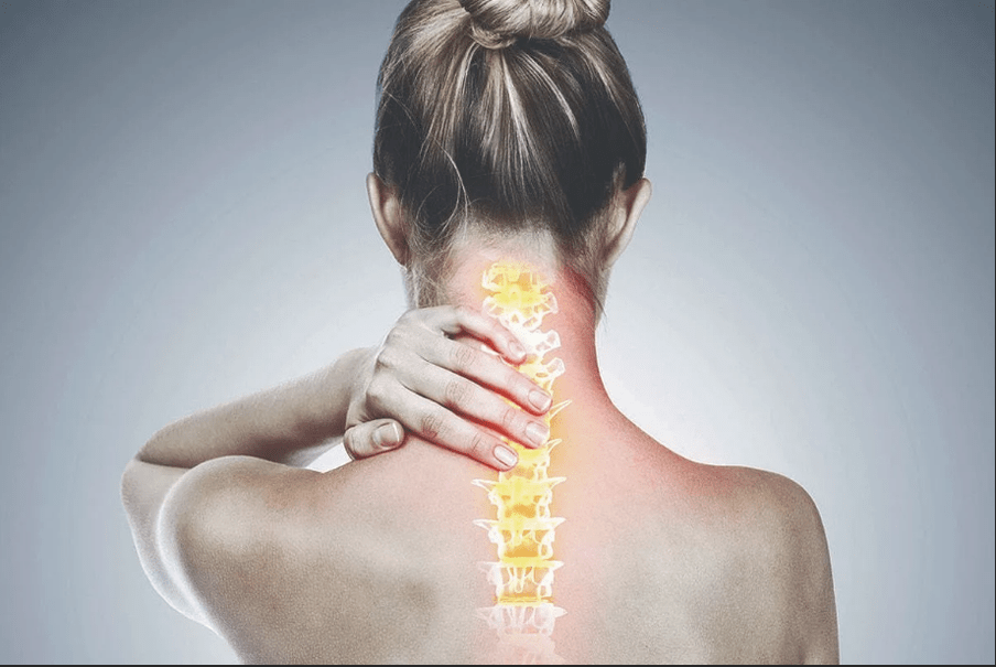 cervical osteochondrosis